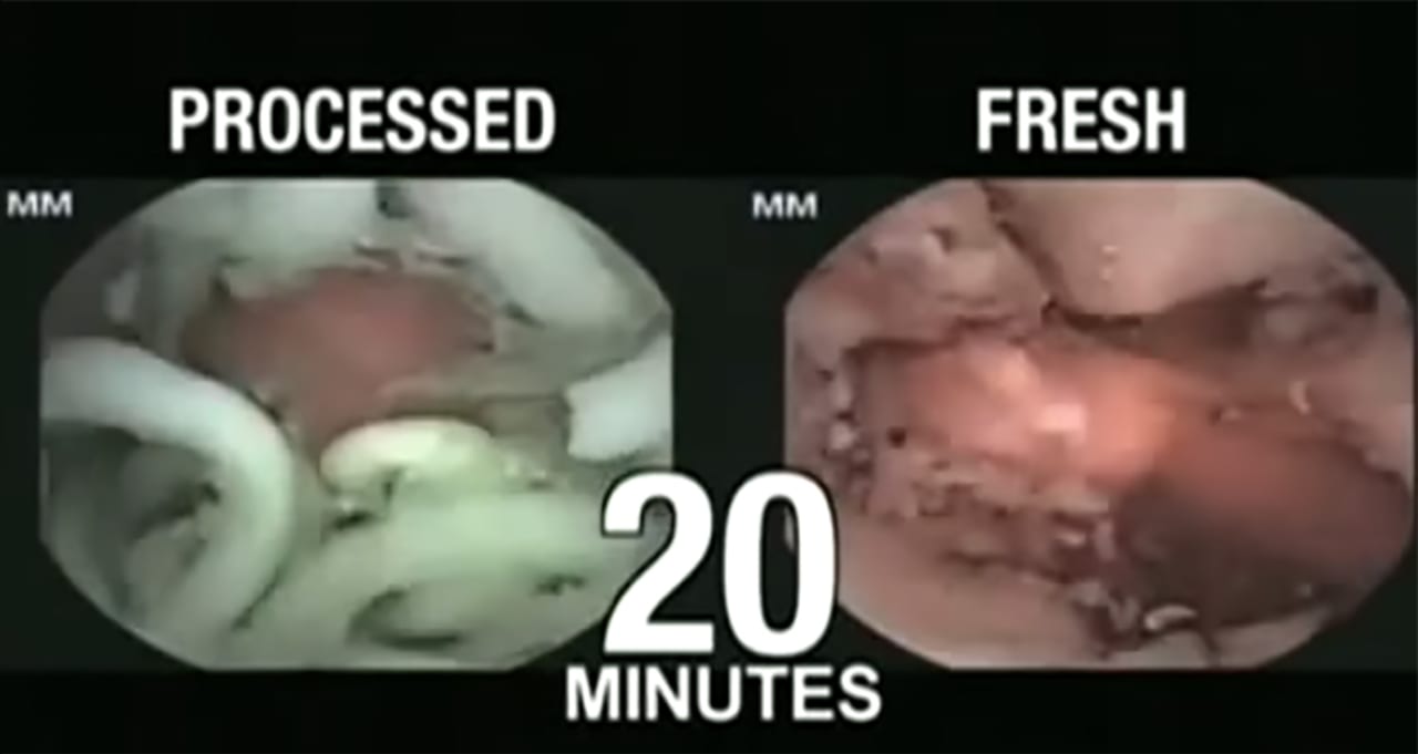 Here S What Happens Inside Your Stomach After You Ingest Instant Ramen First We Feast