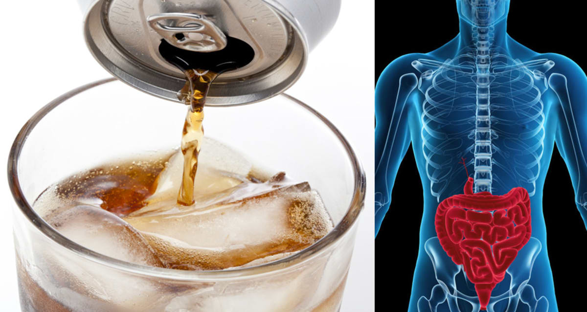 New Study Finds That Diet Soda May Raise Your Risk of Type 2 Diabetes
